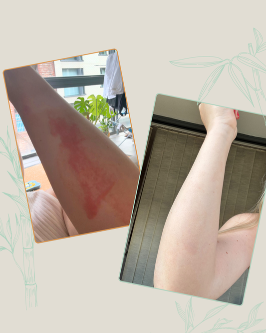 Understanding Skin Irritation and the Benefits of Gentle, Natural Skincare